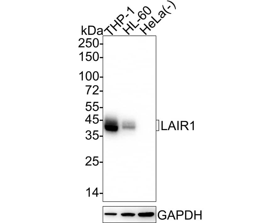 Western blot analysis on different lysates with NBP3-32517 at 1/2,000 dilution. Lane 1: THP-1 cell lysate (20 µg/Lane) Lane 2: HL-60 cell lysate (20 µg/Lane) Lane 3: HeLa cell lysate (negative) (20 µg/Lane) Predicted band size: 32 kDa Observed band size: 40-45 kDa Exposure time: 30 seconds;  4-20% SDS-PAGE gel. Proteins were transferred to a PVDF membrane and blocked with 5% NFDM/TBST for 1 hour at room temperature. NBP3-32517 at 1/2,000 dilution was used in 5% NFDM/TBST at 4℃ overnight. Goat anti-Mouse IgG [HRP] at 1/50,000 dilution was used for 1 hour at room temperature.
