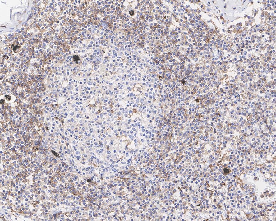 Immunohistochemistry: LAIR1 Antibody (PSH04-50) [NBP3-32517] - Immunohistochemical analysis of paraffin-embedded human lymph node tissue with Mouse anti-LAIR1 antibody (NBP3-32517) at 1/200 dilution. The section was pre-treated using heat mediated antigen retrieval with Tris-EDTA buffer (pH 9.0) for 20 minutes. The tissues were blocked in 1% BSA for 20 minutes at room temperature, washed with ddH2O and PBS, and then probed with the primary antibody (NBP3-32517) at 1/200 dilution for 1 hour at room temperature. The detection was performed using an HRP conjugated compact polymer system. DAB was used as the chromogen. Tissues were counterstained with hematoxylin and mounted with DPX.