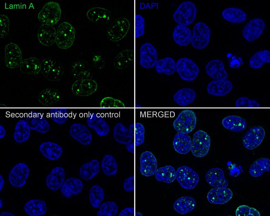 Immunocytochemistry/ Immunofluorescence: Lamin A + C Antibody (A6F5-R) [NBP3-32518] - Immunocytochemistry analysis of HeLa cells labeling Lamin A + C with Mouse anti-Lamin A + C antibody (NBP3-32518) at 1/100 dilution. Cells were fixed in 100% precooled methanol for 5 minutes at room temperature, then blocked with 1% BSA in 10% negative goat serum for 1 hour at room temperature. Cells were then incubated with Mouse anti-Lamin A + C antibody (NBP3-32518) at 1/100 dilution in 1% BSA in PBST overnight at 4 ℃. Goat Anti-Mouse IgG H&L (iFluor™ 488) was used as the secondary antibody at 1/1,000 dilution. PBS instead of the primary antibody was used as the secondary antibody only control. Nuclear DNA was labelled in blue with DAPI.
