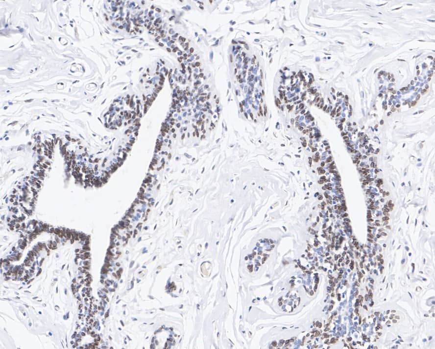 Immunohistochemistry: Lamin A + C Antibody (A6F5-R) [NBP3-32518] - Immunohistochemical analysis of paraffin-embedded human breast tissue with Mouse anti-Lamin A + C antibody (NBP3-32518) at 1/200 dilution. The section was pre-treated using heat mediated antigen retrieval with sodium citrate buffer (pH 6.0) for 2 minutes. The tissues were blocked in 1% BSA for 20 minutes at room temperature, washed with ddH2O and PBS, and then probed with the primary antibody (NBP3-32518) at 1/200 dilution for 1 hour at room temperature. The detection was performed using an HRP conjugated compact polymer system. DAB was used as the chromogen. Tissues were counterstained with hematoxylin and mounted with DPX.