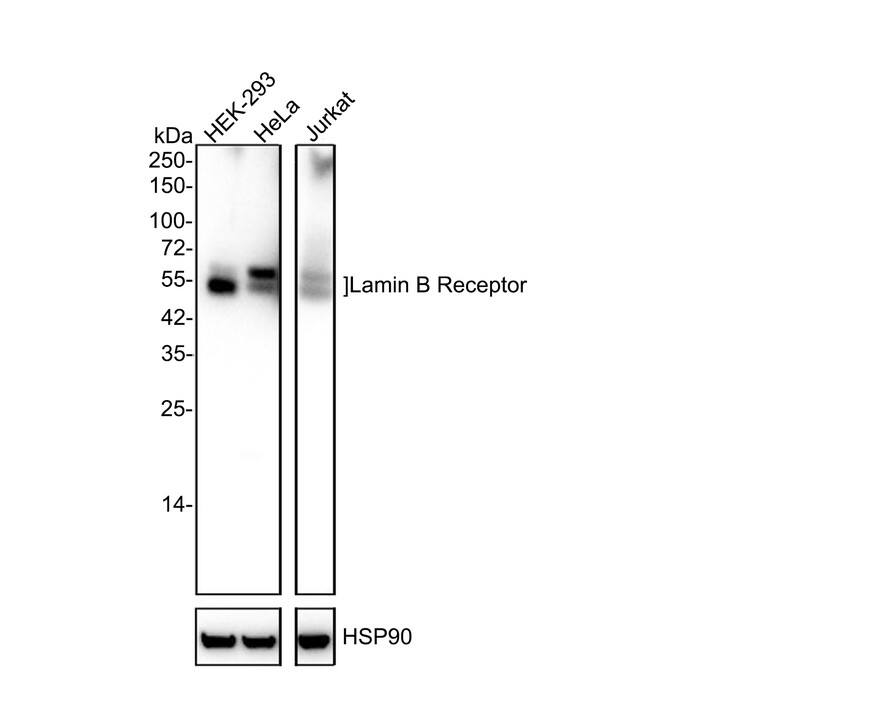 Western blot analysis on different lysates with NBP3-32519 at 1/2,000 dilution. Lane 1: HEK-293 cell lysate Lane 2: HeLa cell lysate Lane 3: Jurkat cell lysate Lysates/proteins at 20 µg/Lane. Predicted band size: 71 kDa Observed band size: 58 kDa Exposure time: Lane 1-2: 1 minute 2 seconds; Lane 3: 5 seconds; 4-20% SDS-PAGE gel. Proteins were transferred to a PVDF membrane and blocked with 5% NFDM/TBST for 1 hour at room temperature. NBP3-32519 at 1/2,000 dilution was used in 5% NFDM/TBST at 4℃ overnight. Goat Anti-Rabbit IgG [HRP] Secondary Antibody at 1/50,000 dilution was used for 1 hour at room temperature.