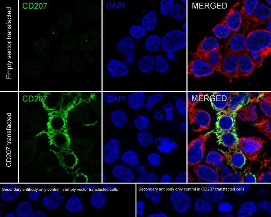 Immunocytochemistry/ Immunofluorescence: Langerin/CD207 Antibody (PSH04-60) [NBP3-32524] - Immunocytochemistry analysis of 293T cells transfected with or without Langerin/CD207 labeling Langerin/CD207 with Rabbit anti-Langerin/CD207 antibody (NBP3-32524) at 1/2,500 dilution. Cells were fixed in 4% paraformaldehyde for 20 minutes at room temperature, permeabilized with 0.1% Triton X-100 in PBS for 5 minutes at room temperature, then blocked with 1% BSA in 10% negative goat serum for 1 hour at room temperature. Cells were then incubated with Rabbit anti-Langerin antibody (NBP3-32524) at 1/2,500 dilution in 1% BSA in PBST overnight at 4 ℃. Goat Anti-Rabbit IgG H&L (iFluor™ 488) was used as the secondary antibody at 1/1,000 dilution. PBS instead of the primary antibody was used as the secondary antibody only control. Nuclear DNA was labelled in blue with DAPI. Beta tubulin (red) was stained at 1/100 dilution overnight at +4℃. Goat Anti-Mouse IgG H&L (iFluor™ 594) was used as the secondary antibody at 1/1,000 dilution.