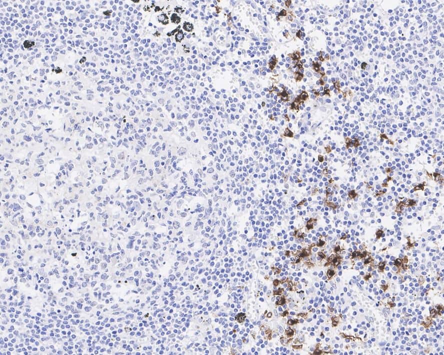 Immunohistochemistry: Langerin/CD207 Antibody (PSH04-60) [NBP3-32524] - Immunohistochemical analysis of paraffin-embedded human lymph nodes tissue with Rabbit anti-Langerin/CD207 antibody (NBP3-32524) at 1/4,000 dilution. The section was pre-treated using heat mediated antigen retrieval with Tris-EDTA buffer (pH 9.0) for 20 minutes. The tissues were blocked in 1% BSA for 20 minutes at room temperature, washed with ddH2O and PBS, and then probed with the primary antibody (NBP3-32524) at 1/4,000 dilution for 1 hour at room temperature. The detection was performed using an HRP conjugated compact polymer system. DAB was used as the chromogen. Tissues were counterstained with hematoxylin and mounted with DPX.