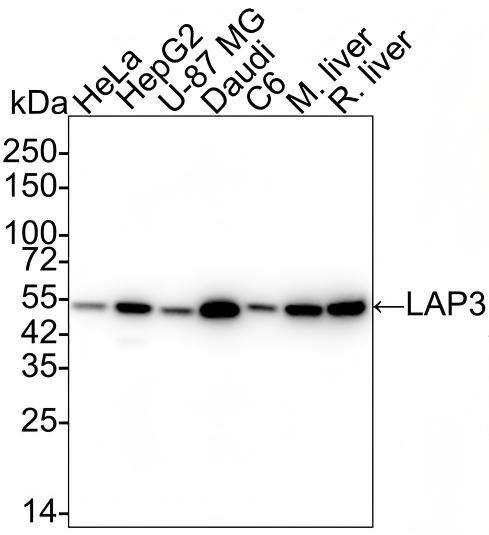 Western blot analysis on different lysates with NBP3-32525 at 1/5,000 dilution and competitor's antibody at 1/1,000 dilution. Lane 1: HeLa cell lysate (15 µg/Lane) Lane 2: HepG2 cell lysate (15 µg/Lane) Lane 3: U-87 MG cell lysate (15 µg/Lane) Lane 4: Daudi cell lysate (15 µg/Lane) Lane 5: C6 cell lysate (15 µg/Lane) Lane 6: Mouse liver tissue lysate (30 µg/Lane) Lane 7: Rat liver tissue lysate (30 µg/Lane) Predicted band size: 56 kDa Observed band size: 50 kDa Exposure time: Lane 1-7 (left): 1 minute; Lane 1-7 (right): 3 minutes;  4-20% SDS-PAGE gel. Proteins were transferred to a PVDF membrane and blocked with 5% NFDM/TBST for 1 hour at room temperature. NBP3-32525 at 1/5,000 dilution and competitor's antibody at 1/1,000 dilution were used in 5% NFDM/TBST at 4℃ overnight. Goat Anti-Rabbit IgG [HRP] Secondary Antibody at 1/50,000 dilution was used for 1 hour at room temperature.