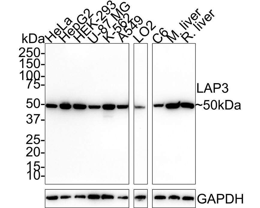 Western blot analysis on different lysates with NBP3-32525 at 1/1,000 dilution. Lane 1: HeLa cell lysate (20 µg/Lane) Lane 2: HepG2 cell lysate (20 µg/Lane) Lane 3: HEK-293 cell lysate (20 µg/Lane) Lane 4: U-87 MG cell lysate (20 µg/Lane) Lane 5: K-562 cell lysate (20 µg/Lane) Lane 6: A549 cell lysate (20 µg/Lane) Lane 7: LO2 cell lysate (20 µg/Lane) Lane 8: C6 cell lysate (20 µg/Lane) Lane 9: Mouse liver tissue lysate (40 µg/Lane) Lane 10: Rat liver tissue lysate (40 µg/Lane) Predicted band size: 56 kDa Observed band size: 50 kDa Exposure time: 1 minute 40 seconds;  4-20% SDS-PAGE gel. Proteins were transferred to a PVDF membrane and blocked with 5% NFDM/TBST for 1 hour at room temperature. NBP3-32525 at 1/1,000 dilution was used in 5% NFDM/TBST at room temperature for 2 hours. Goat Anti-Rabbit IgG [HRP] Secondary Antibody at 1/100,000 dilution was used for 1 hour at room temperature.