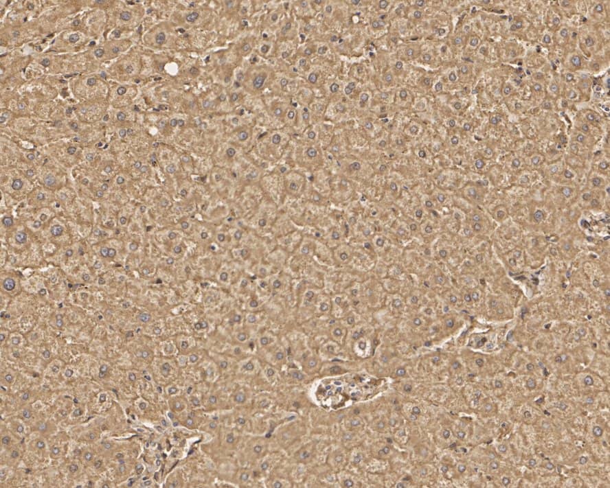 Immunohistochemistry: LAP3 Antibody (PSH01-26) [NBP3-32525] - Immunohistochemical analysis of paraffin-embedded human liver tissue with Rabbit anti-LAP3 antibody (NBP3-32525) at 1/1,000 dilution. The section was pre-treated using heat mediated antigen retrieval with Tris-EDTA buffer (pH 9.0) for 20 minutes. The tissues were blocked in 1% BSA for 20 minutes at room temperature, washed with ddH2O and PBS, and then probed with the primary antibody (NBP3-32525) at 1/1,000 dilution for 1 hour at room temperature. The detection was performed using an HRP conjugated compact polymer system. DAB was used as the chromogen. Tissues were counterstained with hematoxylin and mounted with DPX.