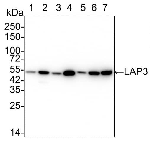 Western Blot: LAP3 Antibody (PSH01-26) [NBP3-32525] - Western blot analysis of LAP3 on different lysates with Rabbit anti-LAP3 antibody (NBP3-32525) at 1/5,000 dilution. Lane 1: HeLa cell lysate (15 µg/Lane) Lane 2: HepG2 cell lysate (15 µg/Lane) Lane 3: U-87 MG cell lysate (15 µg/Lane) Lane 4: Daudi cell lysate (15 µg/Lane) Lane 5: C6 cell lysate (15 µg/Lane) Lane 6: Mouse liver tissue lysate (30 µg/Lane) Lane 7: Rat liver tissue lysate (30 µg/Lane) Predicted band size: 56 kDa Observed band size: 50 kDa Exposure time:  Lane 1-7 (left): 1 minute;  Lane 1-7 (right): 3 minutes; 4-20% SDS-PAGE gel. Proteins were transferred to a PVDF membrane and blocked with 5% NFDM/TBST for 1 hour at room temperature. The primary antibody at 1/5,000 dilution was used in 5% NFDM/TBST at 4℃ overnight. Goat Anti-Rabbit IgG - HRP Secondary Antibody at 1/50,000 dilution was used for 1 hour at room temperature.