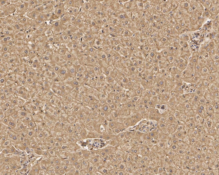 Immunohistochemistry: LAP3 Antibody (PSH01-34) [NBP3-32526] - Immunohistochemical analysis of paraffin-embedded human liver tissue with Rabbit anti-LAP3 antibody (NBP3-32526) at 1/1,000 dilution. The section was pre-treated using heat mediated antigen retrieval with Tris-EDTA buffer (pH 9.0) for 20 minutes. The tissues were blocked in 1% BSA for 20 minutes at room temperature, washed with ddH2O and PBS, and then probed with the primary antibody (NBP3-32526) at 1/1,000 dilution for 1 hour at room temperature. The detection was performed using an HRP conjugated compact polymer system. DAB was used as the chromogen. Tissues were counterstained with hematoxylin and mounted with DPX.