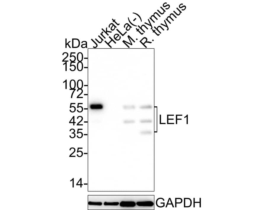 Western blot analysis on different lysates with NBP3-32527 at 1/2,000 dilution. Lane 1: Jurkat cell lysate (20 µg/Lane) Lane 2: HeLa cell lysate (negative) (20 µg/Lane) Lane 3: Mouse thymus tissue lysate (40 µg/Lane) Lane 4: Rat thymus tissue lysate (40 µg/Lane) Predicted band size: 44 kDa Observed band size: 35-55 kDa Exposure time: 3 minutes; 4-20% SDS-PAGE gel. Proteins were transferred to a PVDF membrane and blocked with 5% NFDM/TBST for 1 hour at room temperature. NBP3-32527 at 1/2,000 dilution was used in 5% NFDM/TBST at 4℃ overnight. Goat Anti-Rabbit IgG [HRP] Secondary Antibody at 1/50,000 dilution was used for 1 hour at room temperature.