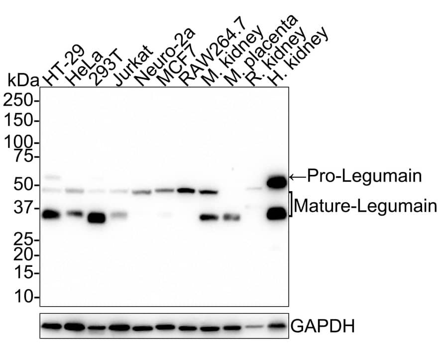 Western Blot: Legumain/Asparaginyl Endopeptidase Antibody (JE35-56) [NBP3-32528] - Western blot analysis of Legumain/Asparaginyl Endopeptidase on different lysates with Rabbit anti-Legumain/Asparaginyl Endopeptidase antibody (NBP3-32528) at 1/1,000 dilution. Lane 1: HT-29 cell lysate (20 ug/Lane) Lane 2: HeLa cell lysate (20 ug/Lane) Lane 3: 293T cell lysate (20 ug/Lane) Lane 4: Jurkat cell lysate (20 ug/Lane) Lane 5: Neuro-2a cell lysate (20 ug/Lane) Lane 6: MCF7 cell lysate (20 ug/Lane) Lane 7: RAW264.7 cell lysate (20 ug/Lane) Lane 8: Mouse kidney tissue lysate (40 ug/Lane) Lane 9: Mouse placenta tissue lysate (40 ug/Lane) Lane 10: Rat kidney tissue lysate (40 ug/Lane) Lane 11: Human kidney tissue lysate (40 ug/Lane) Predicted band size: 49 kDa Observed band size: 36/46/56 kDa Exposure time: 3 minutes; 4-20% SDS-PAGE gel. Proteins were transferred to a PVDF membrane and blocked with 5% NFDM/TBST for 1 hour at room temperature. The primary antibody (NBP3-32528) at 1/1,000 dilution was used in 5% NFDM/TBST at room temperature for 2 hours. Goat Anti-Rabbit IgG - HRP Secondary Antibody at 1:50,000 dilution was used for 1 hour at room temperature.