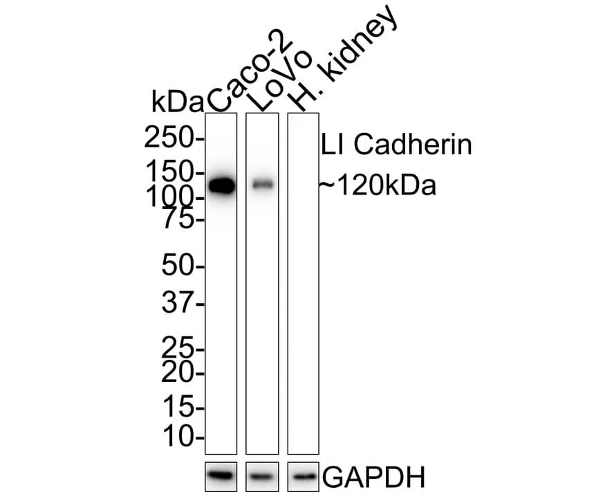 Western Blot: Cadherin-17 Antibody (PD00-49) [NBP3-32534] - Western blot analysis of Cadherin-17 on different lysates with Rabbit anti-Cadherin-17 antibody (NBP3-32534) at 1/1,000 dilution. Lane 1: Caco-2 cell lysate Lane 2: LoVo cell lysate Lane 3: Human kidney tissue lysate (negative) Lysates/proteins at 20 ug/Lane. Predicted band size: 92 kDa Observed band size: 120 kDa Exposure time: 1 minute; 4-20% SDS-PAGE gel. Proteins were transferred to a PVDF membrane and blocked with 5% NFDM/TBST for 1 hour at room temperature. The primary antibody (NBP3-32534) at 1/1,000 dilution was used in 5% NFDM/TBST at 4  overnight. Goat Anti-Rabbit IgG - HRP Secondary Antibody at 1:50,000 dilution was used for 1 hour at room temperature.