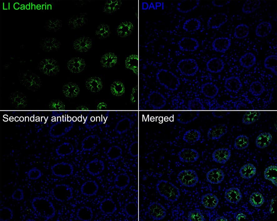 Immunohistochemistry: Cadherin-17 Antibody (PD00-49) [NBP3-32534] - Immunofluorescence analysis of paraffin-embedded human colon tissue labeling Cadherin-17 with Rabbit anti-Cadherin-17 antibody (NBP3-32534) at 1/200 dilution. The section was pre-treated using heat mediated antigen retrieval with Tris-EDTA buffer (pH 9.0) for 20 minutes. The tissues were blocked in 10% negative goat serum for 1 hour at room temperature, washed with PBS, and then probed with the primary antibody (NBP3-32534, green) at 1/200 dilution overnight at 4 ℃, washed with PBS. Goat Anti-Rabbit IgG H&L (iFluor™ 488) was used as the secondary antibody at 1/1,000 dilution. Nuclei were counterstained with DAPI (blue).