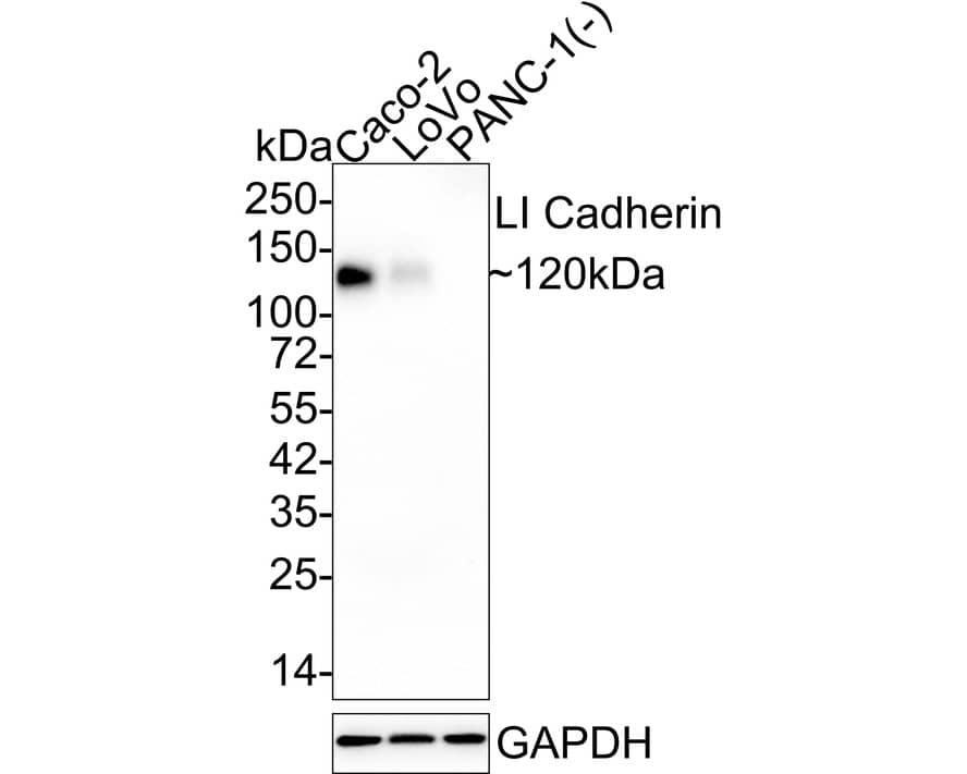 Western blot analysis on different lysates with NBP3-32535 at 1/1,000 dilution. Lane 1: Caco-2 cell lysate (20 µg/Lane) Lane 2: LoVo cell lysate (30 µg/Lane) Lane 3: PANC-1 cell lysate (negative) (30 µg/Lane) Predicted band size: 92 kDa Observed band size: 120 kDa Exposure time: 30 seconds; 4-20% SDS-PAGE gel. Proteins were transferred to a PVDF membrane and blocked with 5% NFDM/TBST for 1 hour at room temperature. NBP3-32535 at 1/1,000 dilution was used in 5% NFDM/TBST at 4℃ overnight. Goat Anti-Rabbit IgG [HRP] Secondary Antibody at 1/50,000 dilution was used for 1 hour at room temperature.