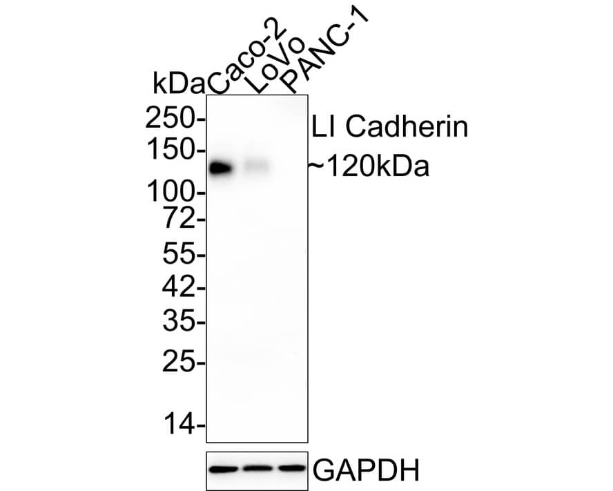 Western Blot: Cadherin-17 Antibody (JE60-34) [NBP3-32535] - Western blot analysis of Cadherin-17 on different lysates with Rabbit anti-Cadherin-17 antibody (NBP3-32535) at 1/1,000 dilution. Lane 1: Caco-2 cell lysate (20 ug/Lane) Lane 2: LoVo cell lysate (30 ug/Lane) Lane 3: PANC-1 cell lysate (negative) (30 ug/Lane) Predicted band size: 92 kDa Observed band size: 120 kDa Exposure time: 30 seconds; 4-20% SDS-PAGE gel. Proteins were transferred to a PVDF membrane and blocked with 5% NFDM/TBST for 1 hour at room temperature. The primary antibody (NBP3-32535) at 1/1,000 dilution was used in 5% NFDM/TBST at 4  overnight. Goat Anti-Rabbit IgG - HRP Secondary Antibody at 1/50,000 dilution was used for 1 hour at room temperature.