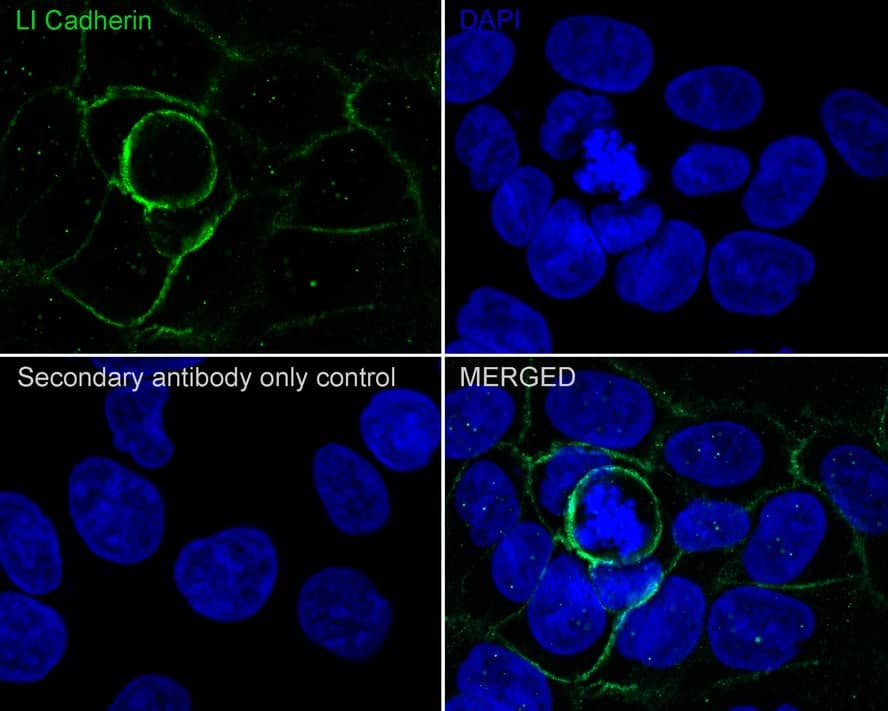 Immunocytochemistry/ Immunofluorescence: Cadherin-17 Antibody (JE60-34) [NBP3-32535] - Immunocytochemistry analysis of Caco-2 cells labeling Cadherin-17 with Rabbit anti-Cadherin-17 antibody (NBP3-32535) at 1/100 dilution. Cells were fixed in 100% precooled methanol for 5 minutes at room temperature, then blocked with 1% BSA in 10% negative goat serum for 1 hour at room temperature. Cells were then incubated with Rabbit anti-Cadherin-17 antibody (NBP3-32535) at 1/100 dilution in 1% BSA in PBST overnight at 4 ℃. Goat Anti-Rabbit IgG H&L (iFluor™ 488) was used as the secondary antibody at 1/1,000 dilution. PBS instead of the primary antibody was used as the secondary antibody only control. Nuclear DNA was labelled in blue with DAPI.