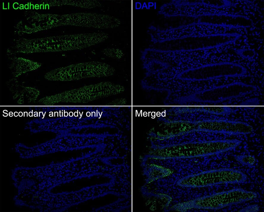 Immunohistochemistry: Cadherin-17 Antibody (JE60-34) [NBP3-32535] - Immunofluorescence analysis of paraffin-embedded human appendix tissue labeling Cadherin-17 with Rabbit anti-Cadherin-17 antibody (NBP3-32535) at 1/100 dilution. The section was pre-treated using heat mediated antigen retrieval with Tris-EDTA buffer (pH 9.0) for 20 minutes. The tissues were blocked in 10% negative goat serum for 1 hour at room temperature, washed with PBS, and then probed with the primary antibody (NBP3-32535, green) at 1/100 dilution overnight at 4 ℃, washed with PBS. Goat Anti-Rabbit IgG H&L (iFluor™ 488) was used as the secondary antibody at 1/1,000 dilution. Nuclei were counterstained with DAPI (blue).