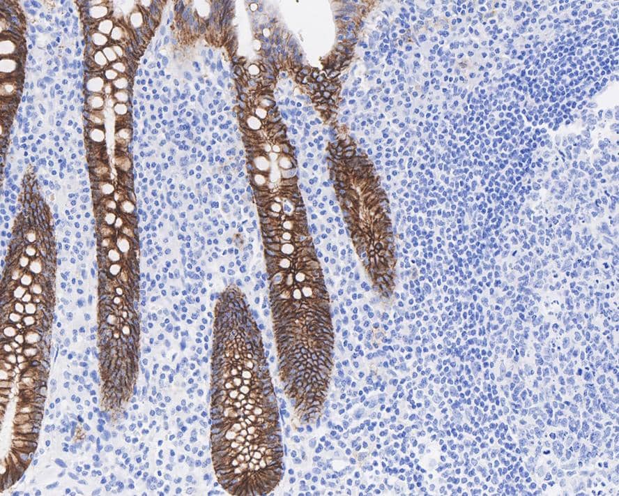 Immunohistochemistry: Cadherin-17 Antibody (JE60-34) [NBP3-32535] - Immunohistochemical analysis of paraffin-embedded human appendix tissue with Rabbit anti-Cadherin-17 antibody (NBP3-32535) at 1/1,000 dilution. The section was pre-treated using heat mediated antigen retrieval with Tris-EDTA buffer (pH 9.0) for 20 minutes. The tissues were blocked in 1% BSA for 20 minutes at room temperature, washed with ddH2O and PBS, and then probed with the primary antibody (NBP3-32535) at 1/1,000 dilution for 1 hour at room temperature. The detection was performed using an HRP conjugated compact polymer system. DAB was used as the chromogen. Tissues were counterstained with hematoxylin and mounted with DPX.