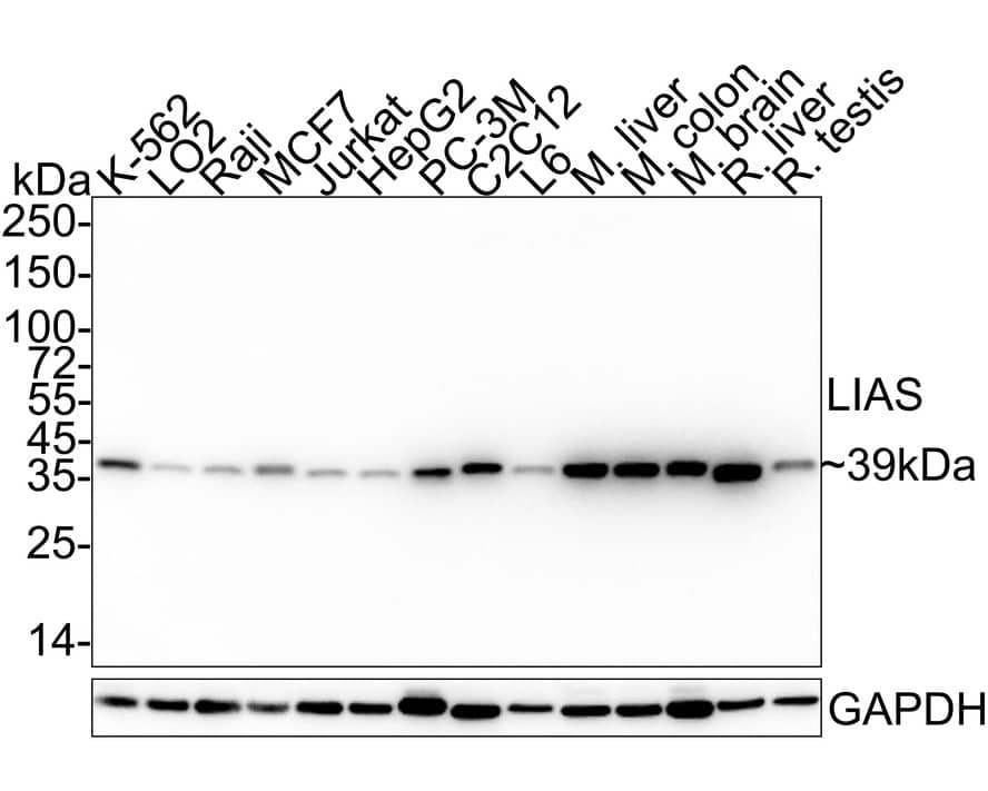 Western Blot LIAS Antibody (PSH04-04)