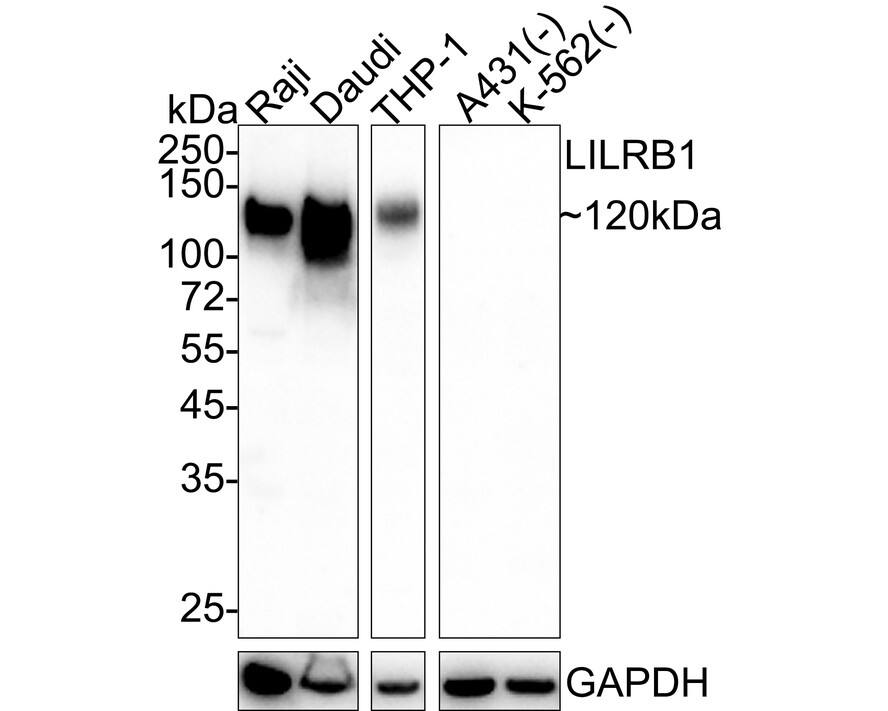 Western blot analysis on different lysates with NBP3-32537 at 1/1,000 dilution. Lane 1: Raji cell lysate Lane 2: Daudi cell lysate Lane 3: THP-1 cell lysate Lane 4: A431 cell lysate (negative) Lane 5: K-562 cell lysate (negative) Lysates/proteins at 20 µg/Lane. Predicted band size: 71 kDa Observed band size: 120 kDa Exposure time: 1 minute; 4-20% SDS-PAGE gel. Proteins were transferred to a PVDF membrane and blocked with 5% NFDM/TBST for 1 hour at room temperature. NBP3-32537 at 1/1,000 dilution was used in 5% NFDM/TBST at 4℃ overnight. Goat Anti-Rabbit IgG [HRP] Secondary Antibody at 1/50,000 dilution was used for 1 hour at room temperature.