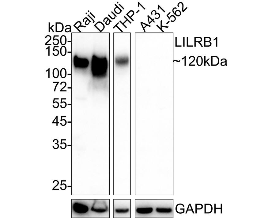 Western Blot: ILT2/CD85j/LILRB1 Antibody (PSH04-59) [NBP3-32537] - Western blot analysis of ILT2/CD85j/LILRB1 on different lysates with Rabbit anti-ILT2/CD85j/LILRB1 antibody (NBP3-32537) at 1/1,000 dilution. Lane 1: Raji cell lysate Lane 2: Daudi cell lysate Lane 3: THP-1 cell lysate Lane 4: A431 cell lysate (negative) Lane 5: K-562 cell lysate (negative) Lysates/proteins at 20 ug/Lane. Predicted band size: 71 kDa Observed band size: 120 kDa Exposure time: 1 minute; ECL; 4-20% SDS-PAGE gel. Proteins were transferred to a PVDF membrane and blocked with 5% NFDM/TBST for 1 hour at room temperature. The primary antibody (NBP3-32537) at 1/1,000 dilution was used in 5% NFDM/TBST at 4  overnight. Goat Anti-Rabbit IgG - HRP Secondary Antibody at 1/50,000 dilution was used for 1 hour at room temperature.