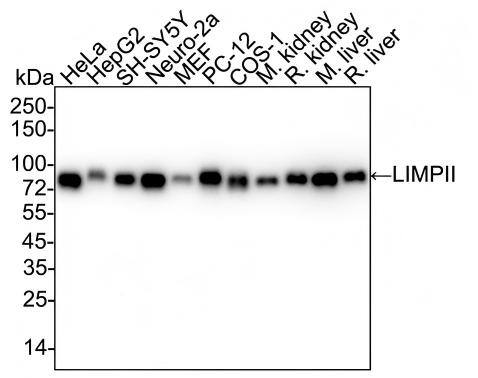 Western blot analysis on different lysates with NBP3-32538 at 1/5,000 dilution and competitor's antibody at 1/5,000 dilution. Lane 1: HeLa cell lysate (15 µg/Lane) Lane 2: HepG2 cell lysate (15 µg/Lane) Lane 3: SH-SY5Y cell lysate (15 µg/Lane) Lane 4: Neuro-2a cell lysate (15 µg/Lane) Lane 5: MEF cell lysate (15 µg/Lane) Lane 6: PC-12 cell lysate (15 µg/Lane) Lane 7: COS-1 cell lysate (15 µg/Lane) Lane 8: Mouse kidney tissue lysate (30 µg/Lane) Lane 9: Rat kidney tissue lysate (30 µg/Lane) Lane 10: Mouse liver tissue lysate (30 µg/Lane) Lane 11: Rat liver tissue lysate (30 µg/Lane) Predicted band size: 54 kDa Observed band size: 80 kDa Exposure time: 30 seconds;  4-20% SDS-PAGE gel. Proteins were transferred to a PVDF membrane and blocked with 5% NFDM/TBST for 1 hour at room temperature. NBP3-32538 at 1/5,000 dilution and competitor's antibody at 1/5,000 dilution were used in 5% NFDM/TBST at 4℃ overnight. Goat Anti-Rabbit IgG [HRP] Secondary Antibody at 1/50,000 dilution was used for 1 hour at room temperature.