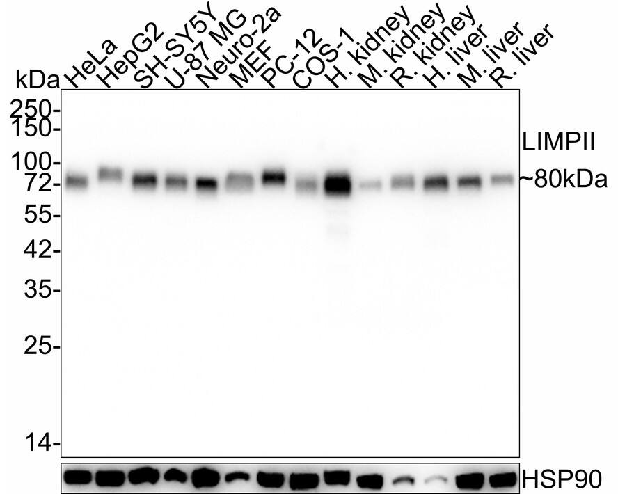 Western blot analysis on different lysates with NBP3-32538 at 1/2,000 dilution. Lane 1: HeLa cell lysate (20 µg/Lane) Lane 2: HepG2 cell lysate (20 µg/Lane) Lane 3: SH-SY5Y cell lysate (20 µg/Lane) Lane 4: U-87 MG cell lysate (20 µg/Lane) Lane 5: Neuro-2a cell lysate (20 µg/Lane) Lane 6: MEF cell lysate (20 µg/Lane) Lane 7: PC-12 cell lysate (20 µg/Lane) Lane 8: COS-1 cell lysate (20 µg/Lane) Lane 9: Human kidney tissue lysate (40 µg/Lane) Lane 10: Mouse kidney tissue lysate (40 µg/Lane) Lane 11: Rat kidney tissue lysate (40 µg/Lane) Lane 12: Human liver tissue lysate (40 µg/Lane) Lane 13: Mouse liver tissue lysate (40 µg/Lane) Lane 14: Rat liver tissue lysate (40 µg/Lane) Predicted band size: 54 kDa Observed band size: 80 kDa Exposure time: 5 seconds;  4-20% SDS-PAGE gel. Proteins were transferred to a PVDF membrane and blocked with 5% NFDM/TBST for 1 hour at room temperature. NBP3-32538 at 1/2,000 dilution was used in 5% NFDM/TBST at 4℃ overnight. Goat Anti-Rabbit IgG [HRP] Secondary Antibody at 1/50,000 dilution was used for 1 hour at room temperature.