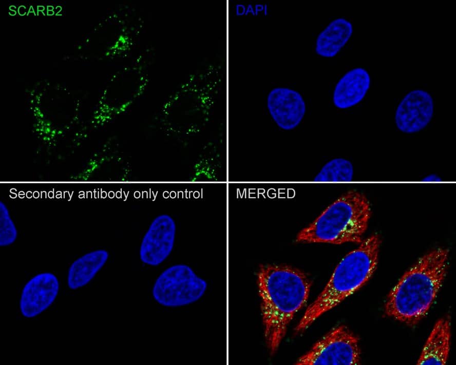 Immunocytochemistry/ Immunofluorescence: LIMPII/SR-B2 Antibody (PSH03-25) [NBP3-32538] - Immunocytochemistry analysis of HeLa cells labeling LIMPII/SR-B2 with Rabbit anti-LIMPII/SR-B2 antibody (NBP3-32538) at 1/200 dilution. Cells were fixed in 100% precooled methanol for 5 minutes at room temperature, then blocked with 1% BSA in 10% negative goat serum for 1 hour at room temperature. Cells were then incubated with Rabbit anti-LIMPII/SR-B2 antibody (NBP3-32538) at 1/200 dilution in 1% BSA in PBST overnight at 4 ℃. Goat Anti-Rabbit IgG H&L (iFluor™ 488) was used as the secondary antibody at 1/1,000 dilution. PBS instead of the primary antibody was used as the secondary antibody only control. Nuclear DNA was labelled in blue with DAPI. Beta tubulin (red) was stained at 1/100 dilution overnight at +4℃. Goat Anti-Mouse IgG H&L (iFluor™ 594) was used as the secondary antibody at 1/1,000 dilution.