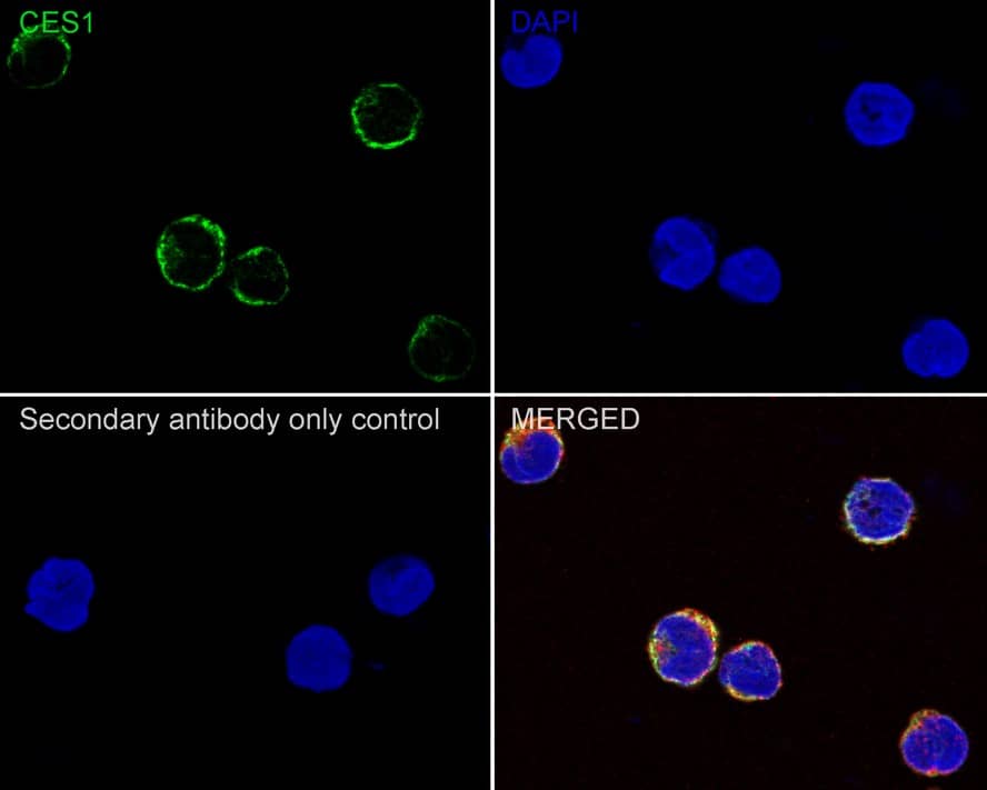 Immunocytochemistry/ Immunofluorescence: Carboxylesterase 1/CES1 Antibody (JE33-04) [NBP3-32541] - Immunocytochemistry analysis of U-937 cells labeling Carboxylesterase 1/CES1 with Rabbit anti-Carboxylesterase 1/CES1 antibody (NBP3-32541) at 1/100 dilution. Cells were fixed in 4% paraformaldehyde for 20 minutes at room temperature, permeabilized with 0.1% Triton X-100 in PBS for 5 minutes at room temperature, then blocked with 1% BSA in 10% negative goat serum for 1 hour at room temperature. Cells were then incubated with Rabbit anti-Carboxylesterase 1/CES1 antibody (NBP3-32541) at 1/100 dilution in 1% BSA in PBST overnight at 4 ℃. Goat Anti-Rabbit IgG H&L (iFluor™ 488) was used as the secondary antibody at 1/1,000 dilution. PBS instead of the primary antibody was used as the secondary antibody only control. Nuclear DNA was labelled in blue with DAPI. Beta tubulin (red) was stained at 1/100 dilution overnight at +4℃. Goat Anti-Mouse IgG H&L (iFluor™ 594) was used as the secondary antibody at 1/1,000 dilution.