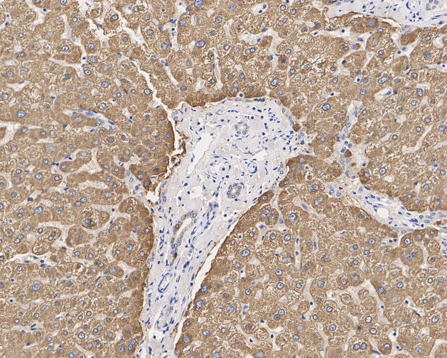 Immunohistochemistry: Carboxylesterase 1/CES1 Antibody (JE33-04) [NBP3-32541] - Immunohistochemical analysis of paraffin-embedded human liver tissue with Rabbit anti-Carboxylesterase 1/CES1 antibody (NBP3-32541) at 1/1,000 dilution. The section was pre-treated using heat mediated antigen retrieval with Tris-EDTA buffer (pH 9.0) for 20 minutes. The tissues were blocked in 1% BSA for 20 minutes at room temperature, washed with ddH2O and PBS, and then probed with the primary antibody (NBP3-32541) at 1/1,000 dilution for 1 hour at room temperature. The detection was performed using an HRP conjugated compact polymer system. DAB was used as the chromogen. Tissues were counterstained with hematoxylin and mounted with DPX.