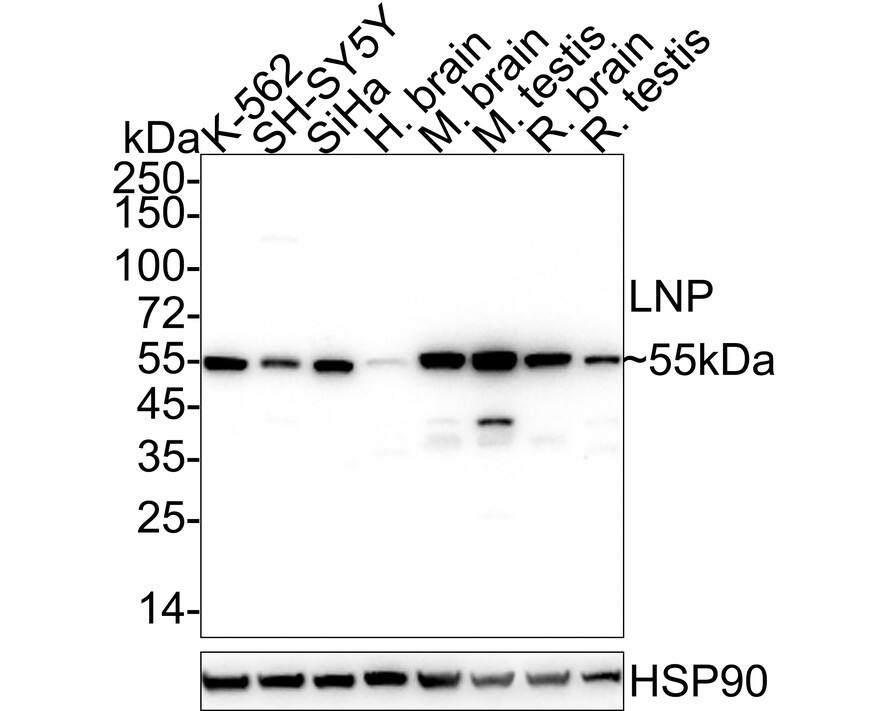 Western Blot Lunapark Antibody (11-1-R)