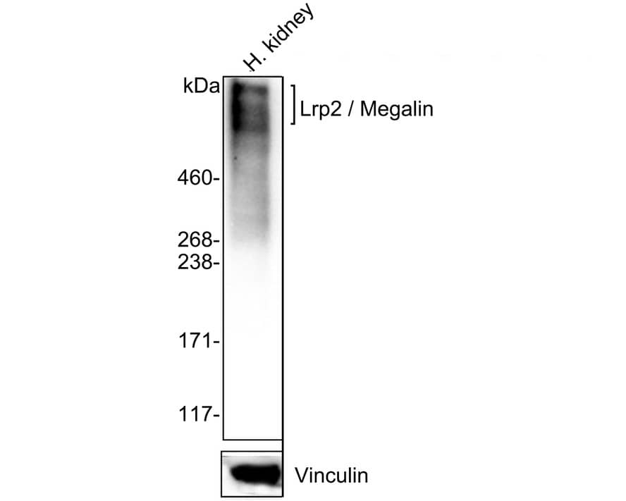 Western Blot: LRP2 Antibody (PSH02-91) [NBP3-32545] - Western blot analysis of LRP2 on human kidney tissue lysates with Rabbit anti-LRP2 antibody (NBP3-32545) at 1/2,000 dilution. Lysates/proteins at 40 ug/Lane. Predicted band size: 522 kDa Observed band size: 600 kDa Exposure time: 2 minutes; 4-20% SDS-PAGE gel. Proteins were transferred to a PVDF membrane and blocked with 5% NFDM/TBST for 1 hour at room temperature. The primary antibody (NBP3-32545) at 1/2,000 dilution was used in 5% NFDM/TBST at 4  overnight. Goat Anti-Rabbit IgG - HRP Secondary Antibody at 1/50,000 dilution was used for 1 hour at room temperature.