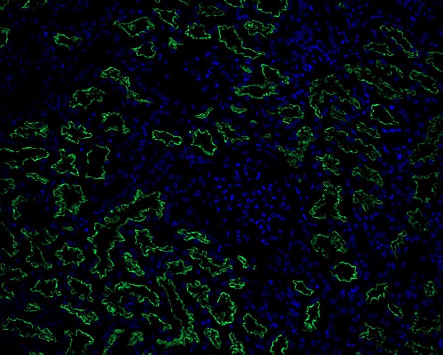 Immunohistochemistry: LRP2 Antibody (PSH02-91) [NBP3-32545] - Immunofluorescence analysis of paraffin-embedded human liver tissue labeling LRP2 with Rabbit anti-LRP2 antibody (NBP3-32545) at 1/50 dilution. The section was pre-treated using heat mediated antigen retrieval with Tris-EDTA buffer (pH 9.0) for 20 minutes. The tissues were blocked in 10% negative goat serum for 1 hour at room temperature, washed with PBS, and then probed with the primary antibody (NBP3-32545, green) at 1/50 dilution overnight at 4 ℃, washed with PBS. Goat Anti-Rabbit IgG H&L (iFluor™ 488) was used as the secondary antibody at 1/1,000 dilution. Nuclei were counterstained with DAPI (blue).