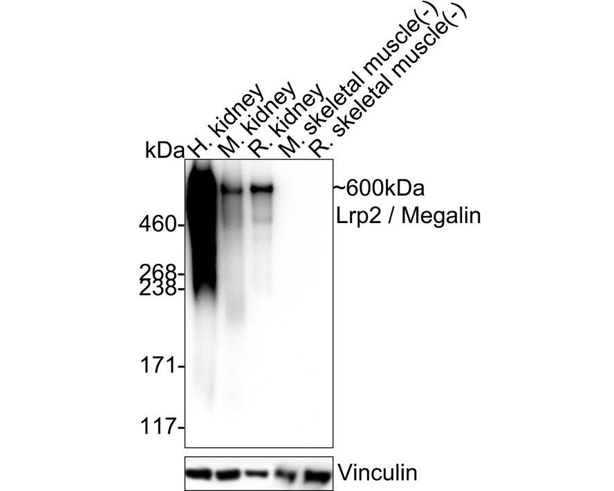 Western blot analysis on different lysates with NBP3-32546 at 1/2,000 dilution. Lane 1: Human kidney tissue lysate Lane 2: Mouse kidney tissue lysate Lane 3: Rat kidney tissue lysate Lane 4: Mouse skeletal muscle tissue lysate (negative) Lane 5: Rat skeletal muscle tissue lysate (negative) Lysates/proteins at 40 µg/Lane. Predicted band size: 522 kDa Observed band size: 600 kDa Exposure time: 20 seconds;  4-20% SDS-PAGE gel. Proteins were transferred to a PVDF membrane and blocked with 5% NFDM/TBST for 1 hour at room temperature. NBP3-32546 at 1/2,000 dilution was used in TBST at 4℃ overnight. Goat Anti-Rabbit IgG [HRP] Secondary Antibody at 1/50,000 dilution was used for 1 hour at room temperature.