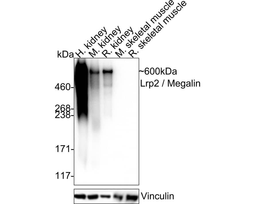 Western Blot: LRP2 Antibody (PSH04-52) [NBP3-32546] - Western blot analysis of LRP2 on different lysates with Rabbit anti-LRP2 antibody (NBP3-32546) at 1/2,000 dilution. Lane 1: Human kidney tissue lysate Lane 2: Mouse kidney tissue lysate Lane 3: Rat kidney tissue lysate Lane 4: Mouse skeletal muscle tissue lysate (negative) Lane 5: Rat skeletal muscle tissue lysate (negative) Lysates/proteins at 40 ug/Lane. Predicted band size: 522 kDa Observed band size: 600 kDa Exposure time: 20 seconds; ECL; 4-20% SDS-PAGE gel. Proteins were transferred to a PVDF membrane and blocked with 5% NFDM/TBST for 1 hour at room temperature. The primary antibody (NBP3-32546) at 1/2,000 dilution was used in TBST at 4  overnight. Goat Anti-Rabbit IgG - HRP Secondary Antibody at 1/50,000 dilution was used for 1 hour at room temperature.