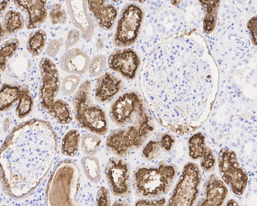 Immunohistochemistry: LRP2 Antibody (PSH04-52) [NBP3-32546] - Immunohistochemical analysis of paraffin-embedded human kidney tissue with Rabbit anti-LRP2 antibody (NBP3-32546) at 1/1,000 dilution. The section was pre-treated using heat mediated antigen retrieval with Tris-EDTA buffer (pH 9.0) for 20 minutes. The tissues were blocked in 1% BSA for 20 minutes at room temperature, washed with ddH2O and PBS, and then probed with the primary antibody (NBP3-32546) at 1/1,000 dilution for 1 hour at room temperature. The detection was performed using an HRP conjugated compact polymer system. DAB was used as the chromogen. Tissues were counterstained with hematoxylin and mounted with DPX.