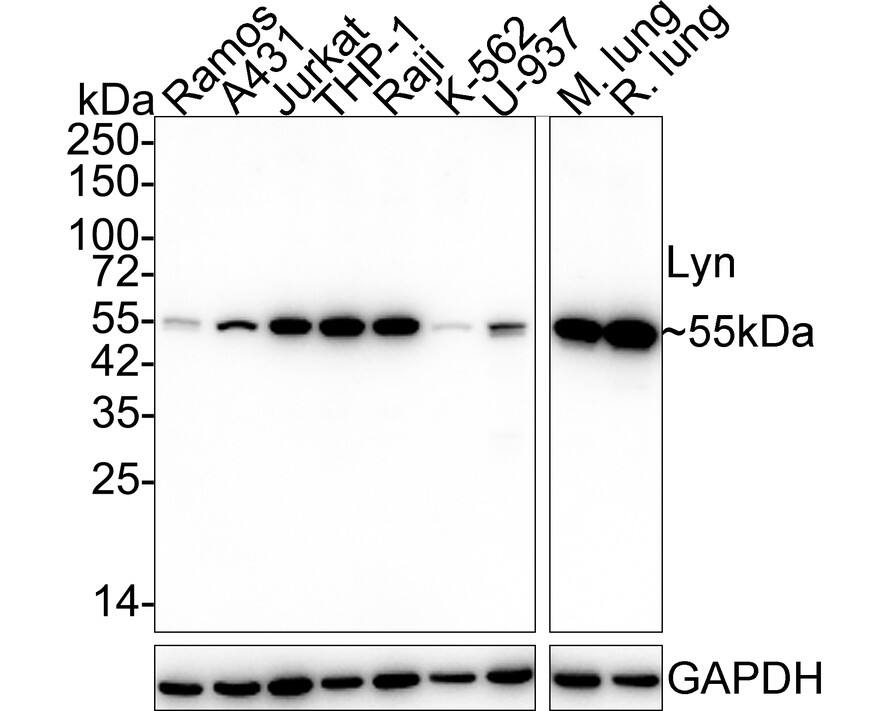 Western blot analysis on different lysates with NBP3-32549 at 1/1,000 dilution. Lane 1: Ramos cell lysate (15 µg/Lane) Lane 2: A431 cell lysate (15 µg/Lane) Lane 3: Jurkat cell lysate (15 µg/Lane) Lane 4: THP-1 cell lysate (15 µg/Lane) Lane 5: Raji cell lysate (15 µg/Lane) Lane 6: K-562 cell lysate (15 µg/Lane) Lane 7: U-937 cell lysate (15 µg/Lane) Lane 8: Mouse lung tissue lysate (30 µg/Lane) Lane 9: Rat lung tissue lysate (30 µg/Lane) Predicted band size: 59 kDa Observed band size: 55 kDa Exposure time: 30 seconds; 4-20% SDS-PAGE gel. Proteins were transferred to a PVDF membrane and blocked with 5% NFDM/TBST for 1 hour at room temperature. NBP3-32549 at 1/1,000 dilution was used in 5% NFDM/TBST at 4℃ overnight. Goat Anti-Rabbit IgG [HRP] Secondary Antibody at 1/50,000 dilution was used for 1 hour at room temperature.