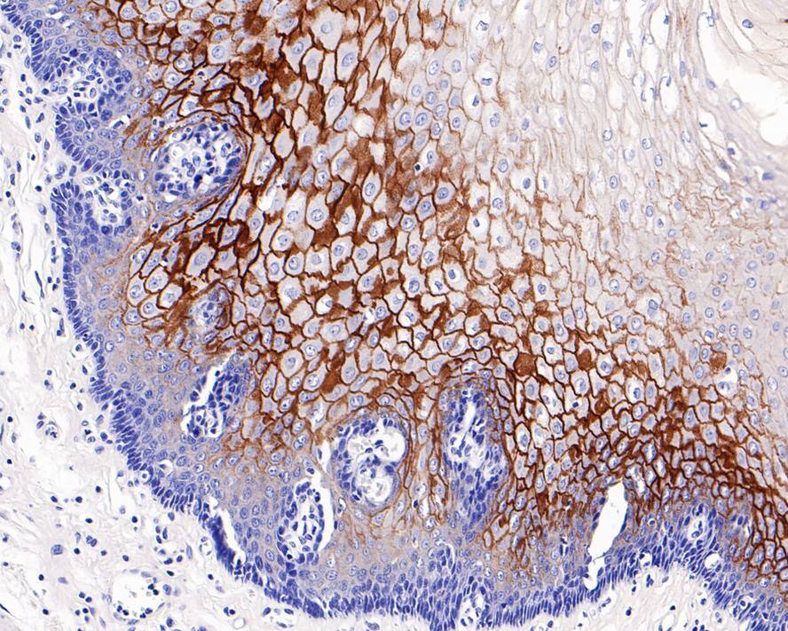 Immunohistochemistry: C4.4A/LYPD3 Antibody (PS00-59) [NBP3-32550] - Immunohistochemical analysis of paraffin-embedded human esophagus tissue with Rabbit anti-C4.4A/LYPD3 antibody (NBP3-32550) at 1/2,000 dilution. The section was pre-treated using heat mediated antigen retrieval with Tris-EDTA buffer (pH 9.0) for 20 minutes. The tissues were blocked in 1% BSA for 20 minutes at room temperature, washed with ddH2O and PBS, and then probed with the primary antibody (NBP3-32550) at 1/2,000 dilution for 1 hour at room temperature. The detection was performed using an HRP conjugated compact polymer system. DAB was used as the chromogen. Tissues were counterstained with hematoxylin and mounted with DPX.