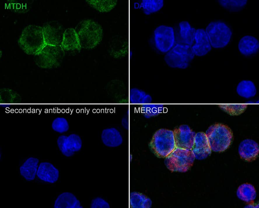 Immunocytochemistry/ Immunofluorescence: Metadherin Antibody (C6-C10-R) [NBP3-32551] - Immunocytochemistry analysis of Jurkat cells labeling Metadherin with Mouse anti-Metadherin antibody (NBP3-32551) at 1/100 dilution. Cells were fixed in 4% paraformaldehyde for 20 minutes at room temperature, permeabilized with 0.1% Triton X-100 in PBS for 5 minutes at room temperature, then blocked with 1% BSA in 10% negative goat serum for 1 hour at room temperature. Cells were then incubated with Mouse anti-Metadherin antibody (NBP3-32551) at 1/100 dilution in 1% BSA in PBST overnight at 4 ℃. Goat Anti-Mouse IgG H&L (iFluor™ 488) was used as the secondary antibody at 1/1,000 dilution. PBS instead of the primary antibody was used as the secondary antibody only control. Nuclear DNA was labelled in blue with DAPI.