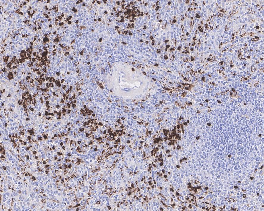 Immunohistochemistry: Lysozyme Antibody (A5A8-R) [NBP3-32552] - Immunohistochemical analysis of paraffin-embedded human spleen tissue with Mouse anti-Lysozyme antibody (NBP3-32552) at 1/1,000 dilution. The section was pre-treated using heat mediated antigen retrieval with Tris-EDTA buffer (pH 9.0) for 20 minutes. The tissues were blocked in 1% BSA for 20 minutes at room temperature, washed with ddH2O and PBS, and then probed with the primary antibody (NBP3-32552) at 1/1,000 dilution for 1 hour at room temperature. The detection was performed using an HRP conjugated compact polymer system. DAB was used as the chromogen. Tissues were counterstained with hematoxylin and mounted with DPX.