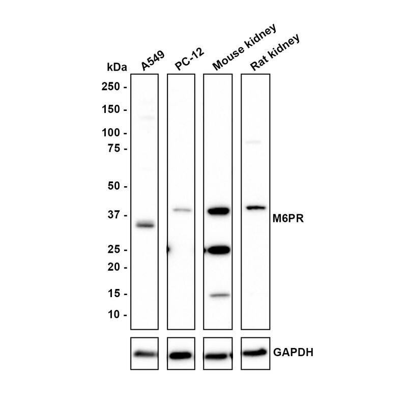 Western Blot CD-M6PR Antibody (PSH01-06)