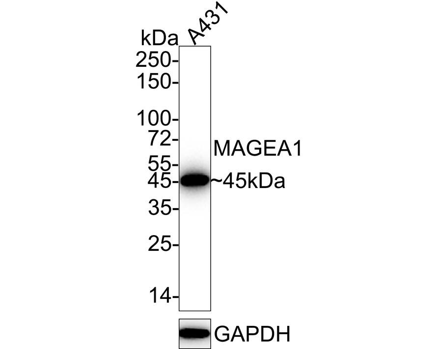 Western blot analysis of  A431 cell lysates with NBP3-32559 at 1/1,000 dilution. Lysates/proteins at 20 µg/Lane. Predicted band size: 34 kDa Observed band size: 45 kDa Exposure time: 25 seconds;  4-20% SDS-PAGE gel. Proteins were transferred to a PVDF membrane and blocked with 5% NFDM/TBST for 1 hour at room temperature. NBP3-32559 at 1/1,000 dilution was used in 5% NFDM/TBST at 4℃ overnight. Goat Anti-Rabbit IgG [HRP] Secondary Antibody at 1/50,000 dilution was used for 1 hour at room temperature.