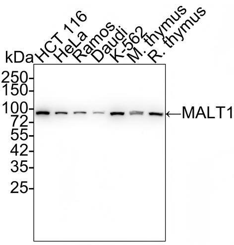 Western blot analysis on different lysates with NBP3-32561 at 1/5,000 dilution and competitor's antibody at 1/1,000 dilution. Lane 1: HCT 116 cell lysate (15 µg/Lane) Lane 2: HeLa cell lysate (15 µg/Lane) Lane 3: Ramos cell lysate (15 µg/Lane) Lane 4: Daudi cell lysate (15 µg/Lane) Lane 5: K-562 cell lysate (15 µg/Lane) Lane 6: Mouse thymus tissue lysate (30 µg/Lane) Lane 7: Rat thymus tissue lysate (30 µg/Lane) Predicted band size: 92 kDa Observed band size: 92 kDa Exposure time: 2 minutes 6 seconds;  4-20% SDS-PAGE gel. Proteins were transferred to a PVDF membrane and blocked with 5% NFDM/TBST for 1 hour at room temperature. NBP3-32561 at 1/5,000 dilution and competitor's antibody at 1/1,000 dilution were used in 5% NFDM/TBST at 4℃ overnight. Goat Anti-Rabbit IgG [HRP] Secondary Antibody at 1/50,000 dilution was used for 1 hour at room temperature.