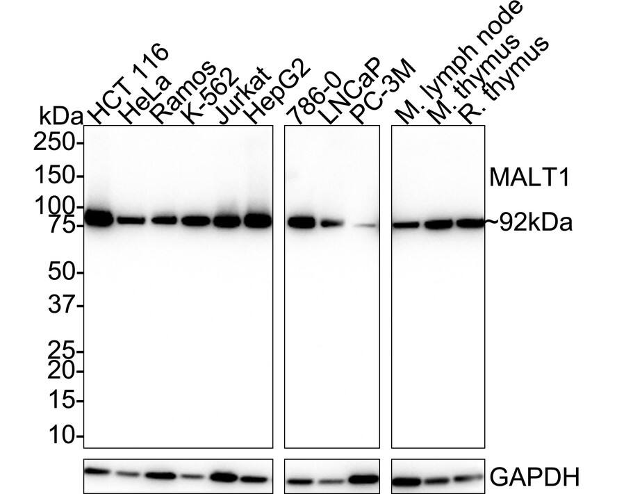 Western blot analysis on different lysates with NBP3-32561 at 1/1,000 dilution. Lane 1: HCT 116 cell lysate (20 µg/Lane) Lane 2: HeLa cell lysate (20 µg/Lane) Lane 3: Ramos cell lysate (20 µg/Lane) Lane 4: K-562 cell lysate (20 µg/Lane) Lane 5: Jurkat cell lysate (20 µg/Lane) Lane 6: HepG2 cell lysate (20 µg/Lane) Lane 7: 786-0 cell lysate (20 µg/Lane) Lane 8: LNCaP cell lysate (20 µg/Lane) Lane 9: PC-3M cell lysate (20 µg/Lane) Lane 10: Mouse lymph node tissue lysate (no heat) (40 µg/Lane) Lane 11: Mouse thymus tissue lysate (40 µg/Lane) Lane 12: Rat thymus tissue lysate (40 µg/Lane) Notice: no heat means the lysate is not boiled. Predicted band size: 92 kDa Observed band size: 92 kDa Exposure time: 37 seconds; 4-20% SDS-PAGE gel. Proteins were transferred to a PVDF membrane and blocked with 5% NFDM/TBST for 1 hour at room temperature. NBP3-32561 at 1/1,000 dilution was used in 5% NFDM/TBST at 4℃ overnight. Goat Anti-Rabbit IgG [HRP] Secondary Antibody at 1/50,000 dilution was used for 1 hour at room temperature.