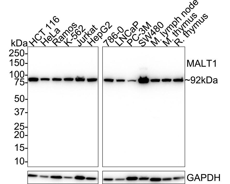 Western blot analysis on different lysates with NBP3-32562 at 1/1,000 dilution. Lane 1: HCT116 cell lysate (20 µg/Lane) Lane 2: HeLa cell lysate (20 µg/Lane) Lane 3: Ramos cell lysate (20 µg/Lane) Lane 4: K-562 cell lysate (20 µg/Lane) Lane 5: Jurkat cell lysate (20 µg/Lane) Lane 6: HepG2 cell lysate (20 µg/Lane) Lane 7: 786-0 cell lysate (20 µg/Lane) Lane 8: LNCaP cell lysate (20 µg/Lane) Lane 9: PC-3M cell lysate (20 µg/Lane) Lane 10: SW480 cell lysate (20 µg/Lane) Lane 11: Mouse lymph node tissue lysate (no heat) (40 µg/Lane) Lane 12: Mouse thymus tissue lysate (40 µg/Lane) Lane 13: Rat thymus tissue lysate (40 µg/Lane) Notice: no heat means the lysate is not boiled. Predicted band size: 92 kDa Observed band size: 92 kDa Exposure time: 43 seconds;  4-20% SDS-PAGE gel. Proteins were transferred to a PVDF membrane and blocked with 5% NFDM/TBST for 1 hour at room temperature. NBP3-32562 at 1/1,000 dilution was used in 5% NFDM/TBST at 4℃ overnight. Goat Anti-Rabbit IgG [HRP] Secondary Antibody at 1/50,000 dilution was used for 1 hour at room temperature.