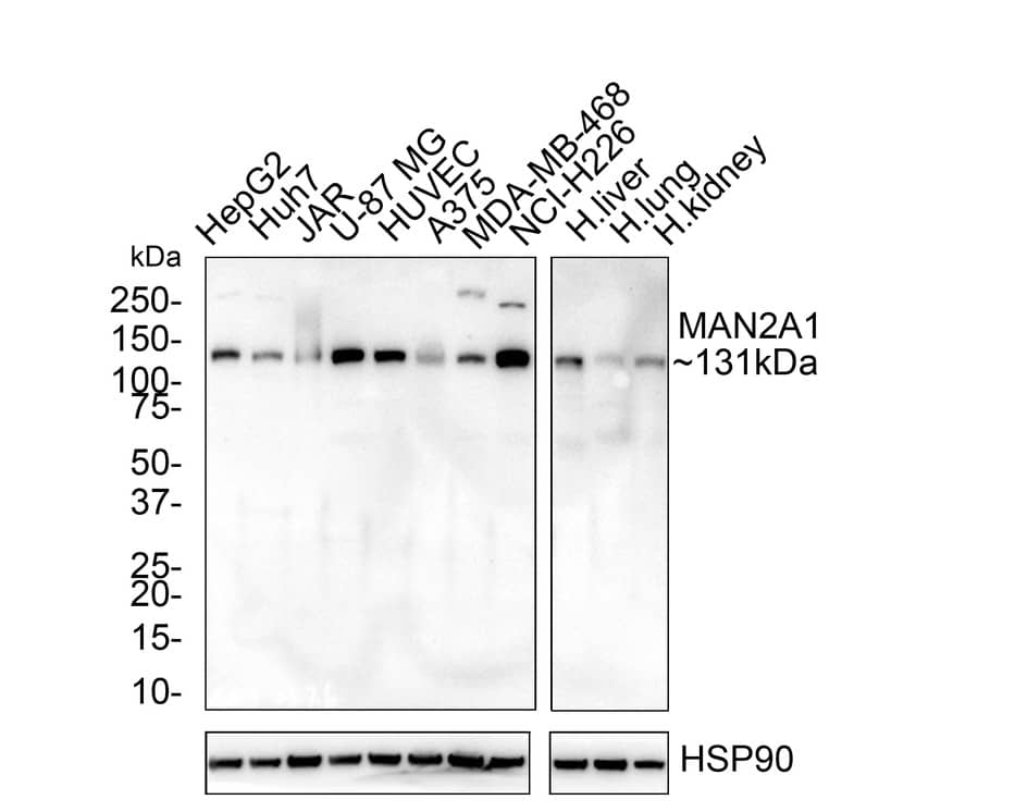 Western Blot Alpha-mannosidase II Antibody (PSH02-67)
