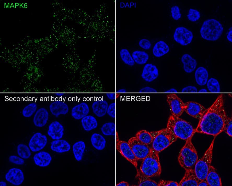 Immunocytochemistry/ Immunofluorescence: ERK3/MAPK6 Antibody (PSH03-39) [NBP3-32567] - Immunocytochemistry analysis of 293T cells labeling ERK3/MAPK6 with Rabbit anti-ERK3/MAPK6 antibody (NBP3-32567) at 1/100 dilution. Cells were fixed in 4% paraformaldehyde for 20 minutes at room temperature, permeabilized with 0.1% Triton X-100 in PBS for 5 minutes at room temperature, then blocked with 1% BSA in 10% negative goat serum for 1 hour at room temperature. Cells were then incubated with Rabbit anti-ERK3/MAPK6 antibody (NBP3-32567) at 1/100 dilution in 1% BSA in PBST overnight at 4 ℃. Goat Anti-Rabbit IgG H&L (iFluor™ 488) was used as the secondary antibody at 1/1,000 dilution. PBS instead of the primary antibody was used as the secondary antibody only control. Nuclear DNA was labelled in blue with DAPI. Beta tubulin (red) was stained at 1/100 dilution overnight at +4℃. Goat Anti-Mouse IgG H&L (iFluor™ 594) was used as the secondary antibody at 1/1,000 dilution.