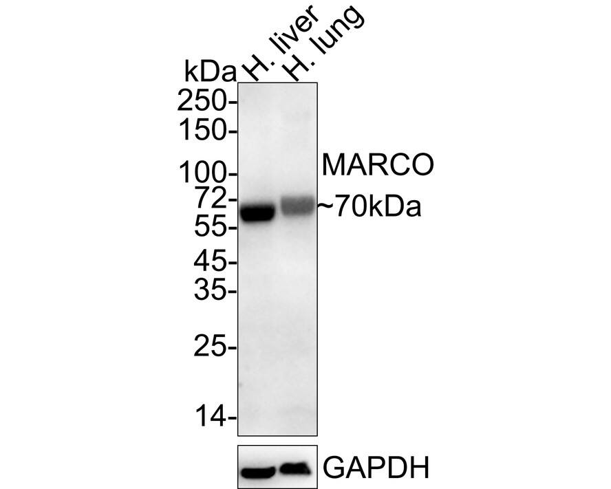 Western Blot: MARCO Antibody (PSH04-31) [NBP3-32568] - Western blot analysis of MARCO on different lysates with Rabbit anti-MARCO antibody (NBP3-32568) at 1/2,000 dilution. Lane 1: Human liver tissue lysate Lane 2: Human lung tissue lysate Lysates/proteins at 40 ug/Lane. Predicted band size: 53 kDa Observed band size: 70 kDa Exposure time: 3 minutes; ECL; 4-20% SDS-PAGE gel. Proteins were transferred to a PVDF membrane and blocked with 5% NFDM/TBST for 1 hour at room temperature. The primary antibody (NBP3-32568) at 1/2,000 dilution was used in 5% NFDM/TBST at 4  overnight. Goat Anti-Rabbit IgG - HRP Secondary Antibody at 1/50,000 dilution was used for 1 hour at room temperature.