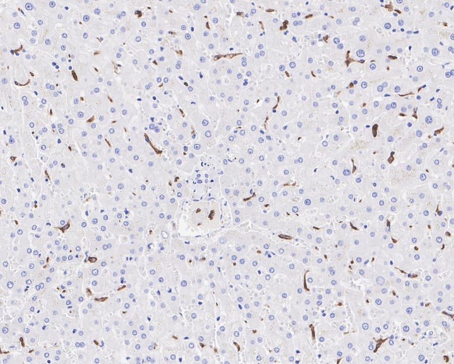Immunohistochemistry: MARCO Antibody (PSH04-31) [NBP3-32568] - Immunohistochemical analysis of paraffin-embedded human liver tissue with Rabbit anti-MARCO antibody (NBP3-32568) at 1/1,000 dilution. The section was pre-treated using heat mediated antigen retrieval with Tris-EDTA buffer (pH 9.0) for 20 minutes. The tissues were blocked in 1% BSA for 20 minutes at room temperature, washed with ddH2O and PBS, and then probed with the primary antibody (NBP3-32568) at 1/1,000 dilution for 1 hour at room temperature. The detection was performed using an HRP conjugated compact polymer system. DAB was used as the chromogen. Tissues were counterstained with hematoxylin and mounted with DPX.