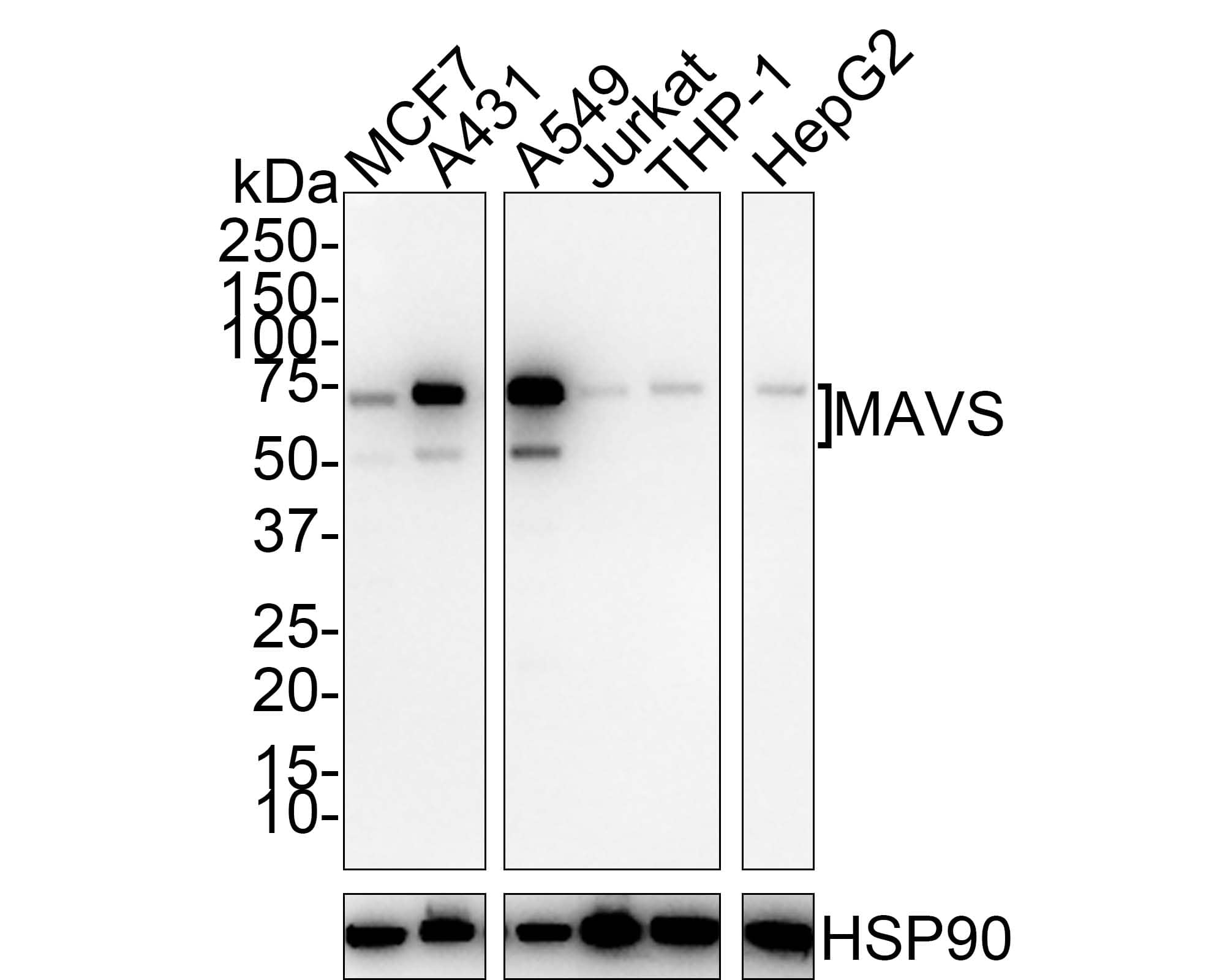 Western blot analysis on different lysates with NBP3-32570 at 1/1,000 dilution. Lane 1: MCF7 cell lysate Lane 2: A431 cell lysate Lane 3: A549 cell lysate Lane 4: Jurkat cell lysate Lane 5: THP-1 cell lysate Lane 6: HepG2 cell lysate Lysates/proteins at 20 µg/Lane. Predicted band size: 56.5 kDa Observed band size: 57/75 kDa Exposure time: 1 minute 46 seconds; 4-20% SDS-PAGE gel. Proteins were transferred to a PVDF membrane and blocked with 5% NFDM/TBST for 1 hour at room temperature. NBP3-32570 at 1/1,000 dilution was used in 5% NFDM/TBST at room temperature for 2 hours. Goat Anti-Rabbit IgG [HRP] Secondary Antibody at 1/100,000 dilution was used for 1 hour at room temperature.