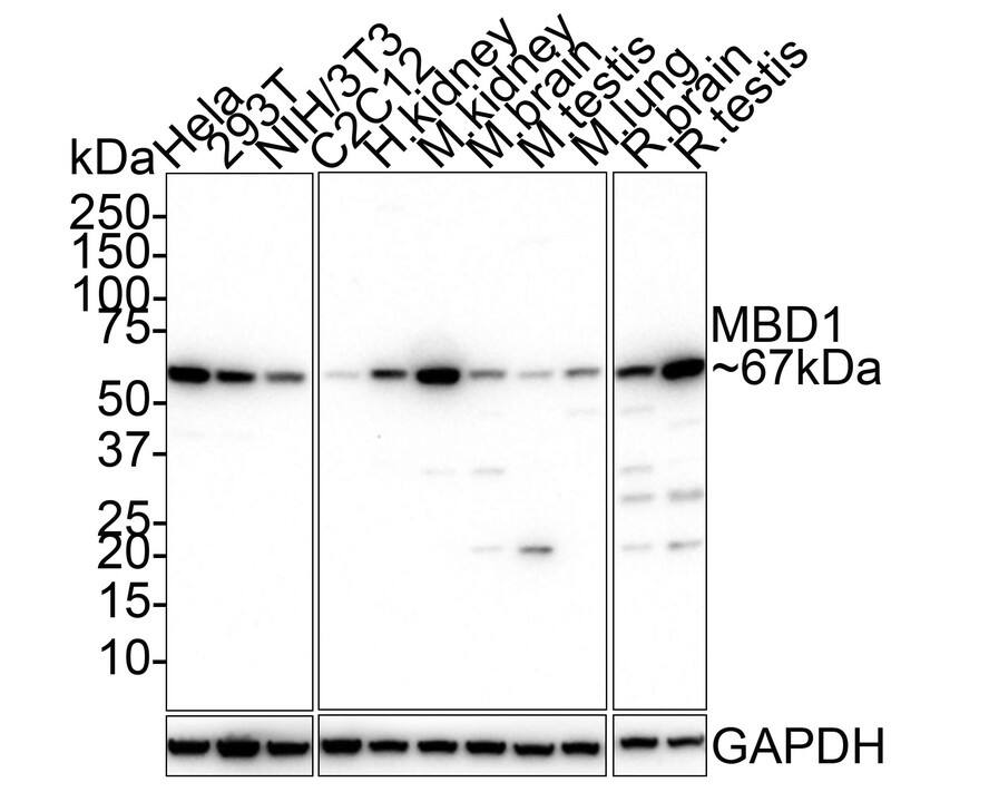 Western blot analysis on different lysates with NBP3-32572 at 1/1,000 dilution. Lane 1: HeLa cell lysate Lane 2: 293T cell lysate Lane 3: NIH/3T3 cell lysate Lane 4: C2C12 cell lysate Lane 5: Human kidney tissue lysate Lane 6: Mouse kidney tissue lysate Lane 7: Mouse brain tissue lysate Lane 8: Mouse testis tissue lysate Lane 9: Mouse lung tissue lysate Lane 10: Rat brain tissue lysate Lane 11: Rat testis tissue lysate Lysates/proteins at 30 µg/Lane. Predicted band size: 67 kDa Observed band size: 67 kDa Exposure time: 2 minutes 18 seconds; 4-20% SDS-PAGE gel. Proteins were transferred to a PVDF membrane and blocked with 5% NFDM/TBST for 1 hour at room temperature. NBP3-32572 at 1/1,000 dilution was used in 5% NFDM/TBST at room temperature for 2 hours. Goat Anti-Rabbit IgG [HRP] Secondary Antibody at 1/50,000 dilution was used for 1 hour at room temperature.